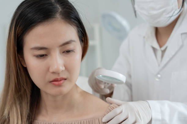 При осмотре дерматовенеролог оценивает наличие пигментации и изменений в текстуре кожи