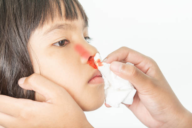 Носовое кровотечение у детей: какие заболевания могут быть причиной?